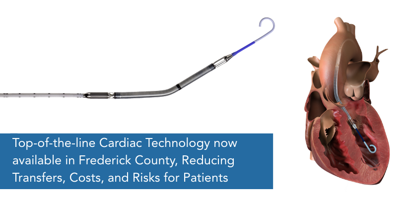 Frederick Health is challenging that model with Impella®, the world’s smallest heart pump, to reduce risks, costs, and the need for patients to be transferred to distant specialty hospitals. 